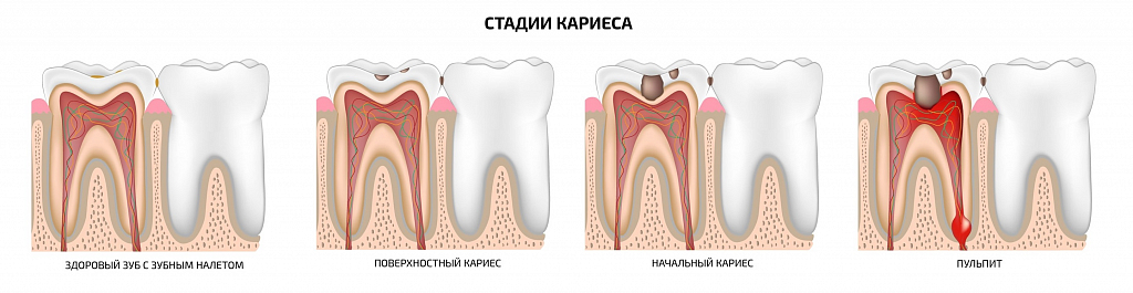 К чему снятся зубы