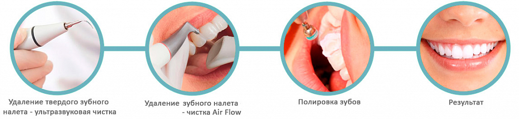 Альвеолит после удаления зуба - симптомы и лечение альвеолита